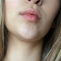baberose Alaston