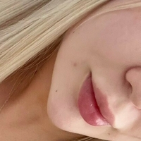 emiliiiaxfree Alaston