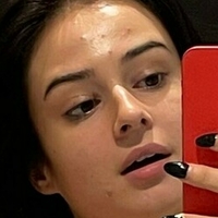 Lauraysergii Alaston