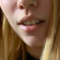 nanaklertits Alaston