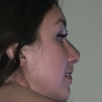 Ronisofine Alaston