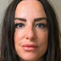 scarred4life3 Alaston