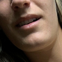 shinytara Alaston