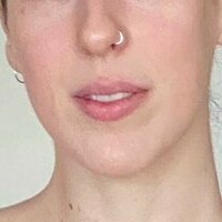 tinytease.39 Alaston